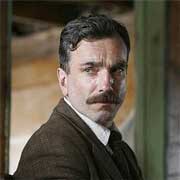 Why no, I don't have dandruff.